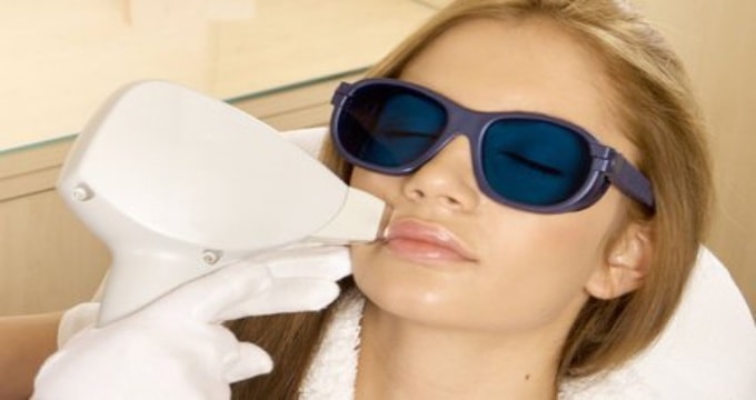 rejuvenare faciala ipl-min